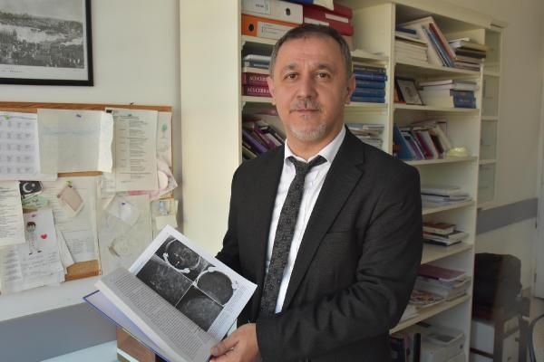 Prof. Dr. Yeniay: Batı illerinde doğuya oranla meme kanseri riski 2,5 kat fazla