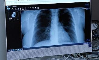 “Afrika sıcaklarıyla akciğer ve alerji hastalıkları da arttı” 