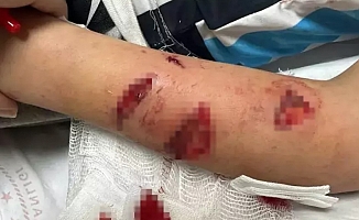 Rize'de dehşet! 12 yaşındaki çocuk, sevdiği köpeğin saldırısına uğradı