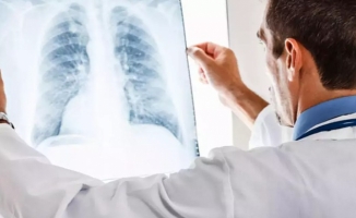 EBUS yöntemi, akciğer hastalıklarında cerrahiye alternatif oluyor