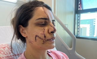 Marmaray'da saldırıya uğrayan kadın yüzündeki 40 dikişle dehşet dolu anları anlattı