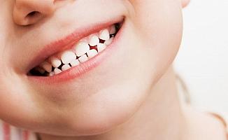 Çocuklarda diş çürüğü neden olur? Nelere dikkat edilmeli?